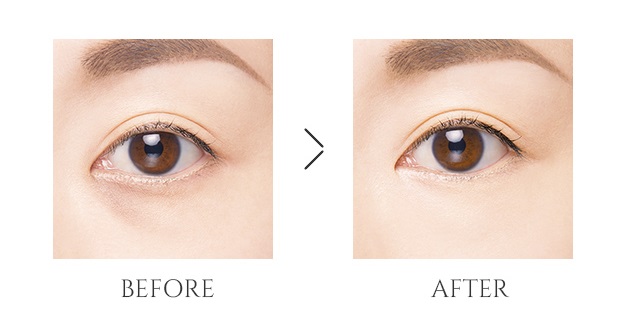 before&after