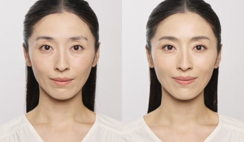Before/After