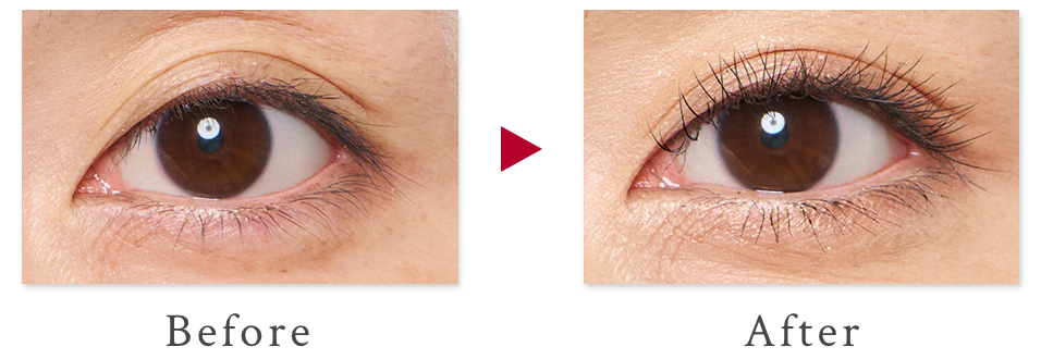 ビフォーアフター画像